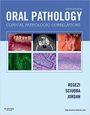 oral pathology clinical pathologic correlations 6th edition regezi test bank